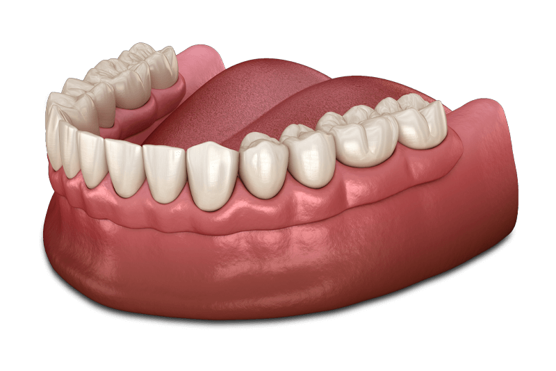 dental denture model